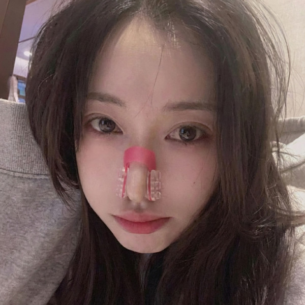 투명 실리콘 코라인보정 코집게 코뽕 클립형 콧볼축소
